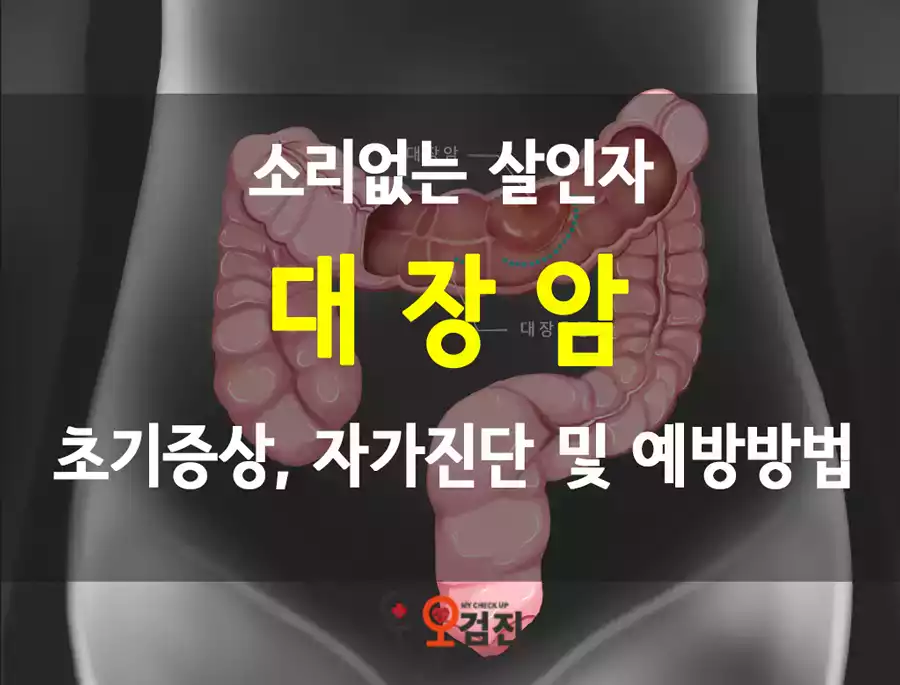 대장암_대표.png